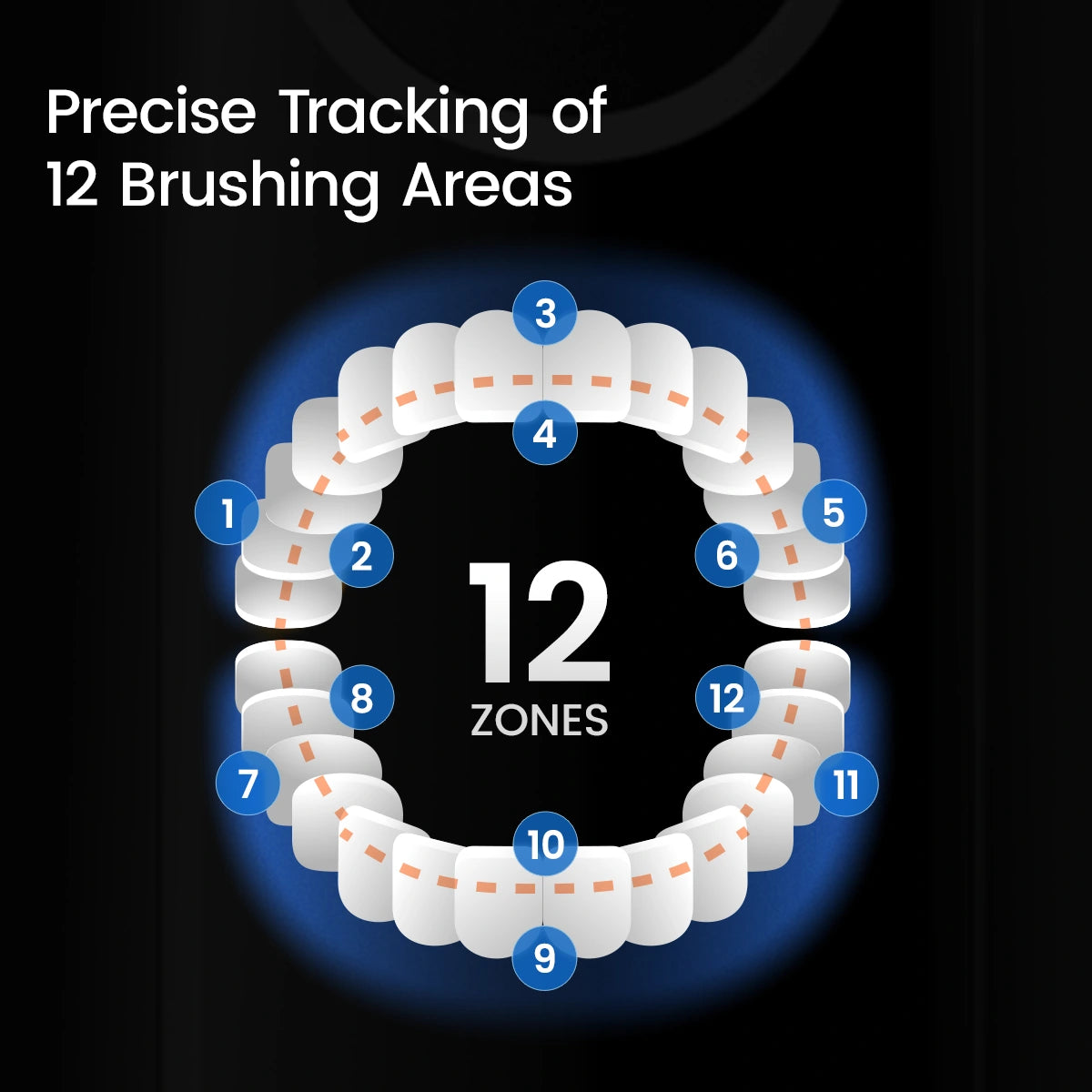 Oclean X Pro 20 S - 12 Brushing Areas